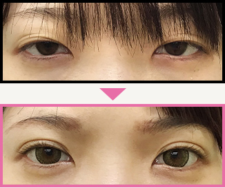 施術例
