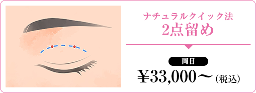ナチュラルクイック法 2点留め
