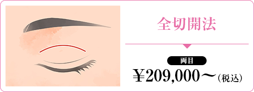 全切開法 切る二重術
