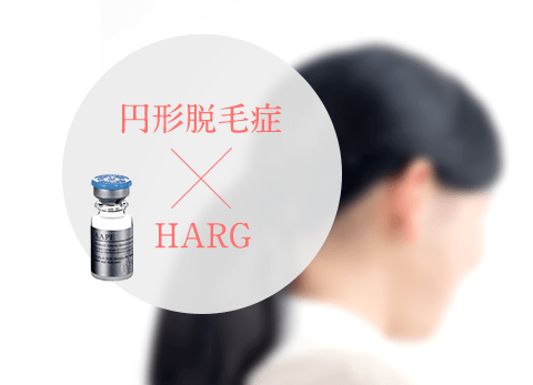 円形脱毛症にもHARGが有効