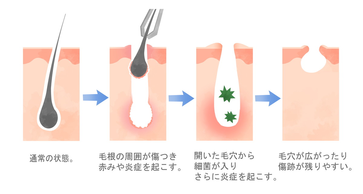 女性医療脱毛  美容外科・美容皮膚科なら中央クリニック