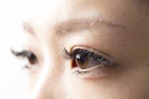 “切らない二重治療”がオススメ!でも・・・お手頃な“広告料金”には裏がある?!