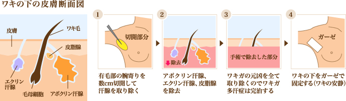 fig-odor-01