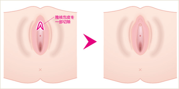 clitoris